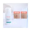 Avène Cleanance Comedomed+
