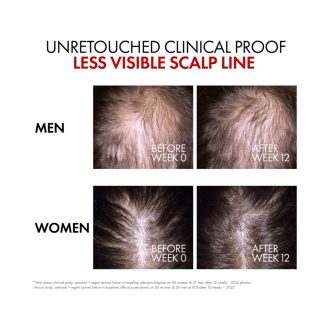 Vichy Dercos Aminexil Clinical REGEN Booster
