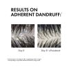Vichy Dercos Anti Dandruff